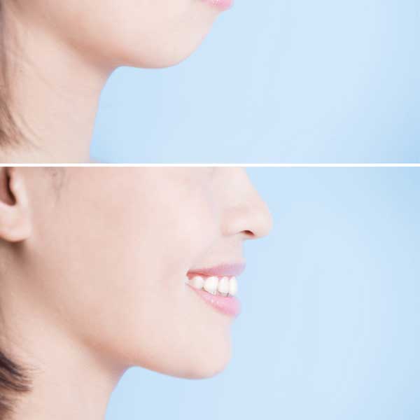 botox injections near me botox injections near me